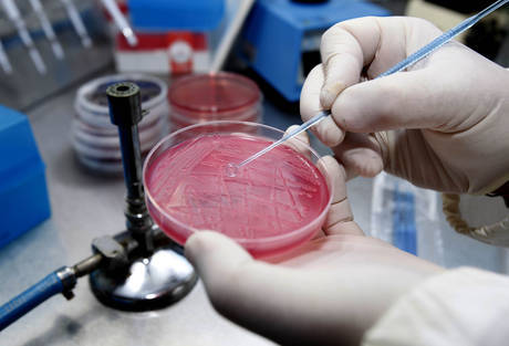 L’OMS HA AFFERMATO CHE LA VARIANTE DELL’ESCHERICHIA COLI E’ NUOVA