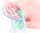 LA PREVENZIONE DEL CARCINOMA COLON RETTO E L’IMPORTANZA DELLO SCREENING