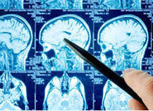 NEUROLOGIA