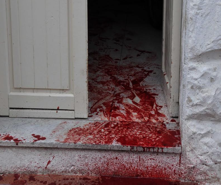 Nessuna aggressione ad extracomunitario. Si era ferito da solo. Grazie alla Polizia non è morto dissanguato
