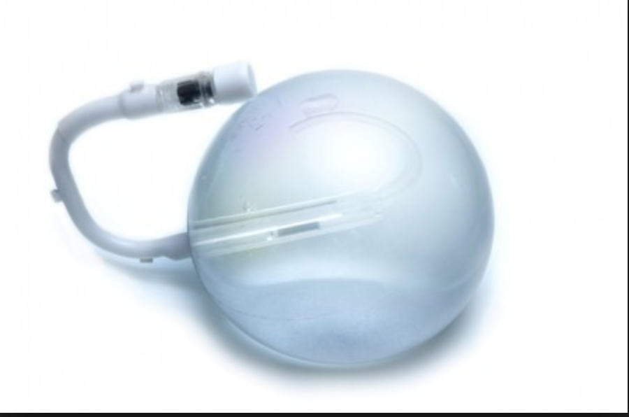 Ingerisce palloncino intragastrico per dimagrire. Muore una 40enne di Modica
