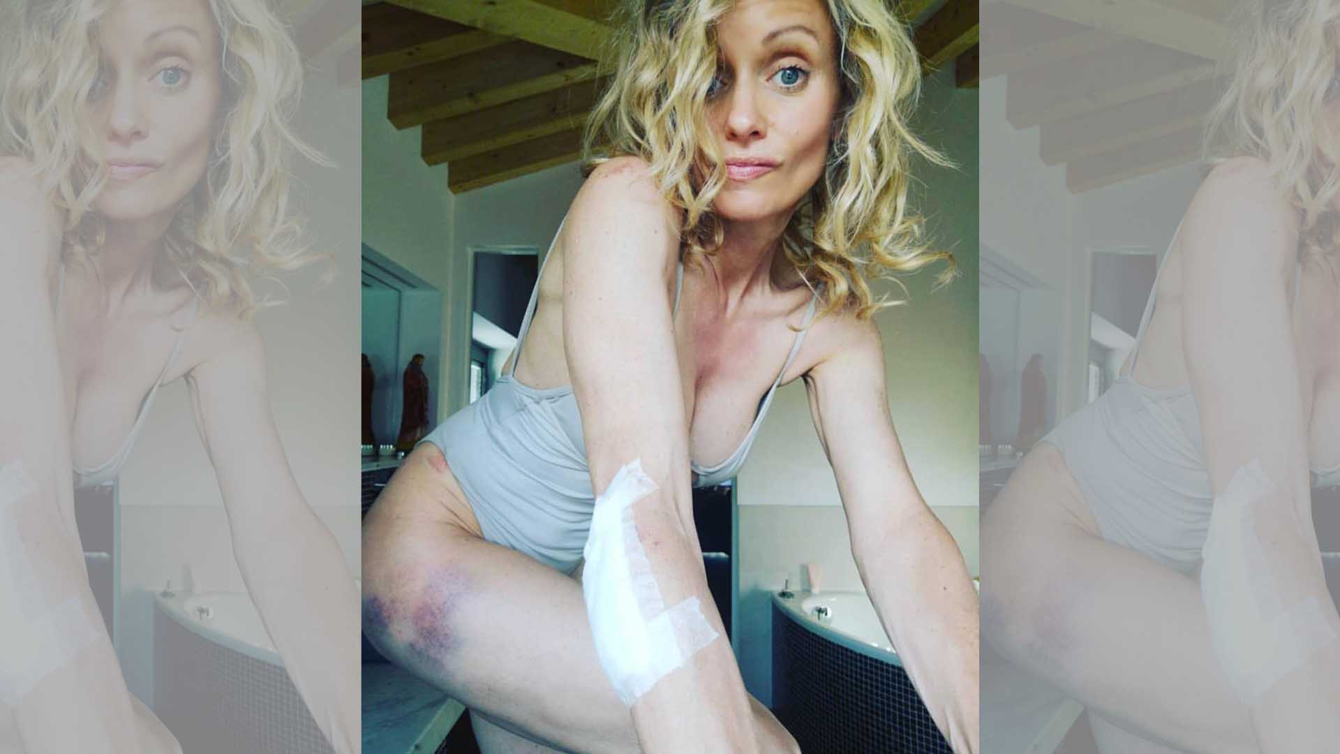 Justine Mattera dopo la sua tappa ragusana cade dalla bici e si ferisce