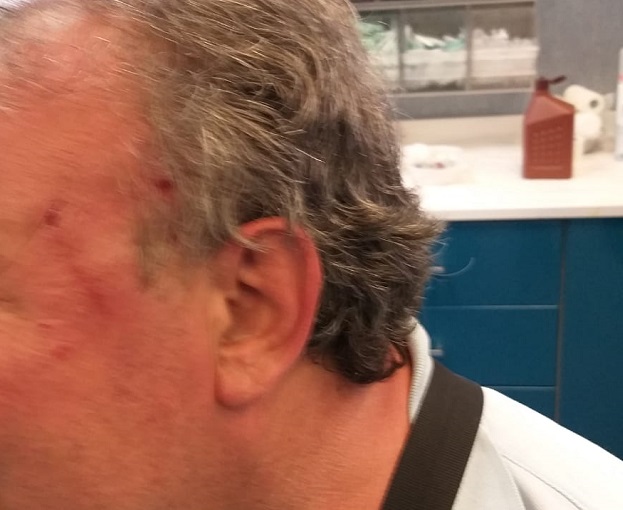 Vigili urbani aggrediti in corso Sicilia a Catania