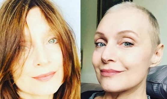 “Jessica” di “Un medico in famiglia” e la sua lotta contro il tumore. Con un sorriso