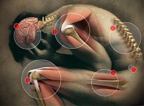 Nasce anche a Ragusa la sezione dell’associazione italiana sindrome fibromialgica