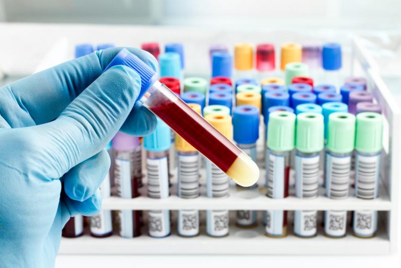 Sciopero dei laboratori analisi fino al 24 febbraio. La regione corre ai riparti e prepara un “piano”