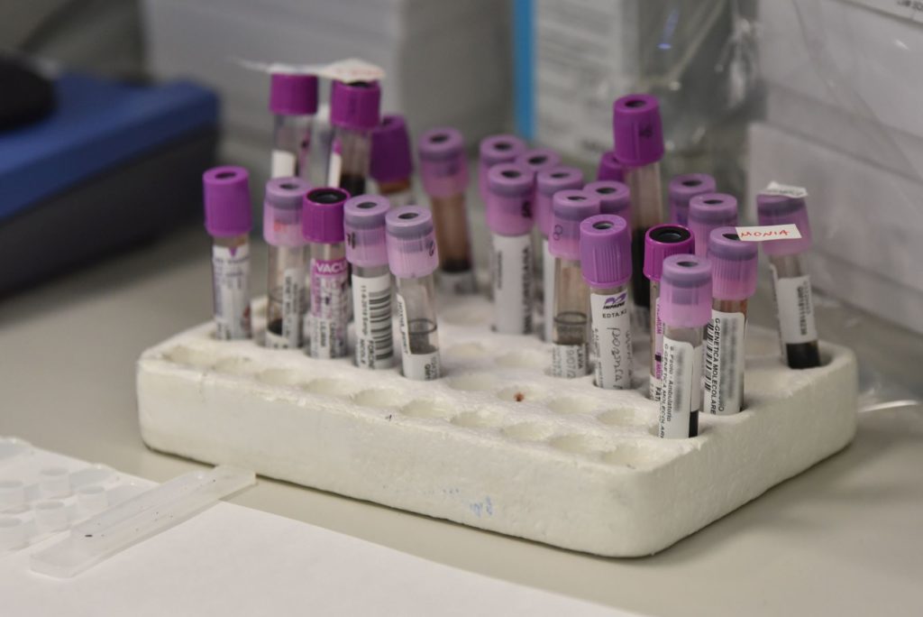 Coronavirus, sale a 7 il numero delle vittime in Italia