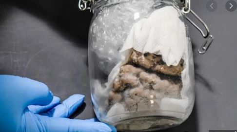 Stati Uniti. Barattolo contenente un cervello umano sequestrato in dogana