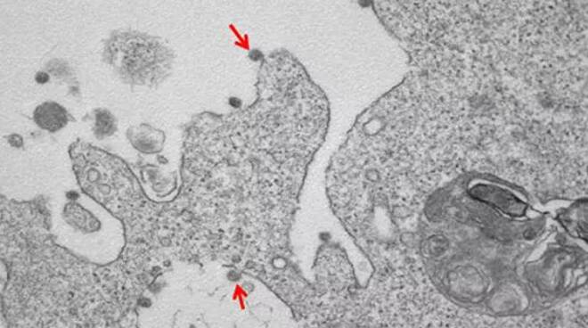 Presentate prime immagini al microscopio del ceppo italiano Sars-CoV-2. Il ceppo italiano potrebbe essere collegato a quello tedesco