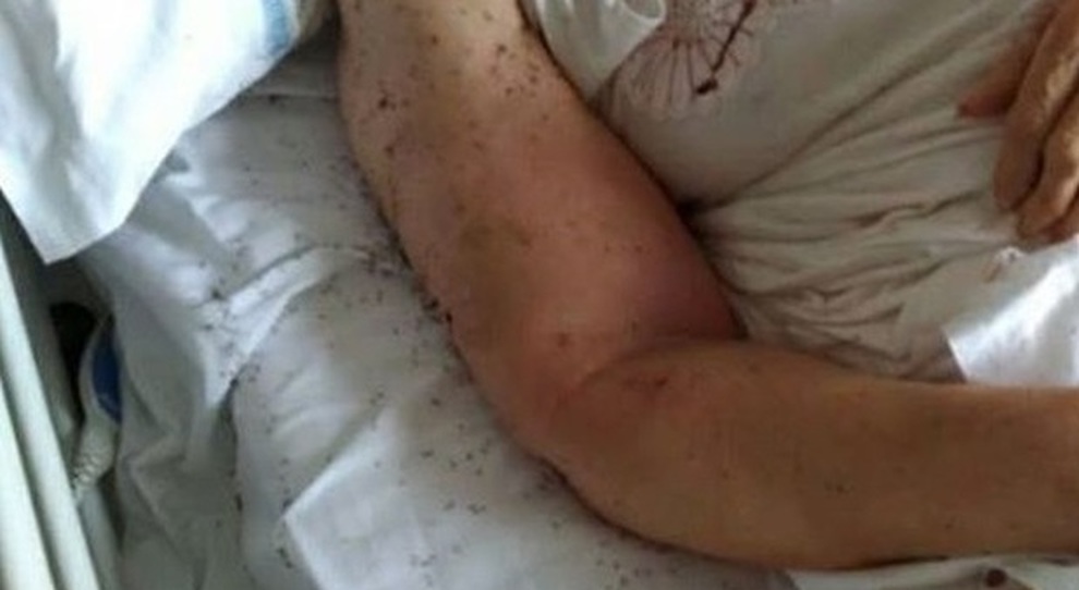 A Palermo, la salma in un’obitorio ricoperta di formiche. La denuncia dei parenti