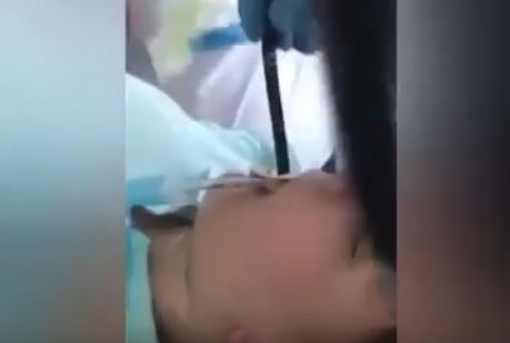 Intervento record in Russia. Rimosso un serpente dall’esofago strisciato nella bocca di una donna che si era addormentata sotto un albero. VIDEO
