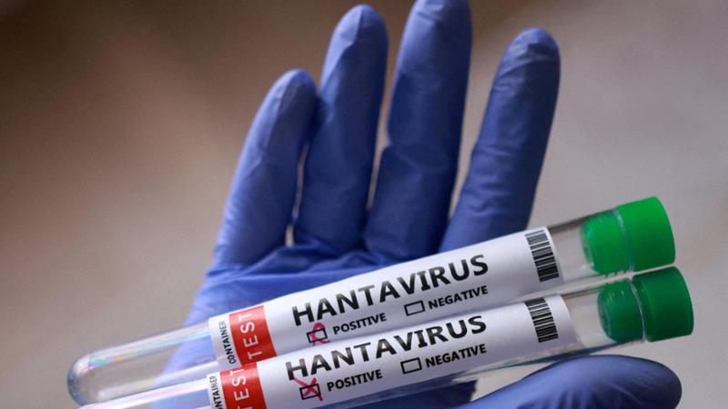 Hantavirus: la Regione Siciliana alza il livello di attenzione sanitaria